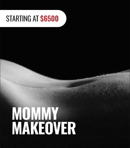 Mommy-Makeover